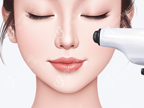 幼态脸皮肤 幼态脸皮肤