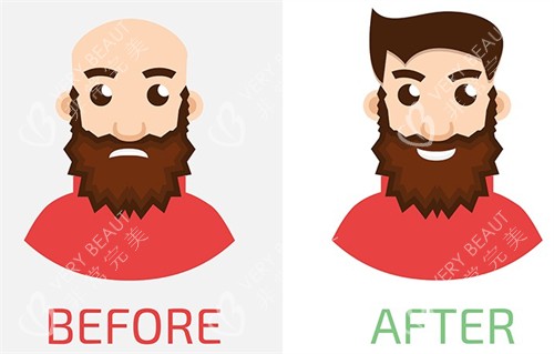 头秃前后种头发对比图 头秃前后种头发对比图