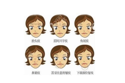 脸上皱纹 脸上皱纹