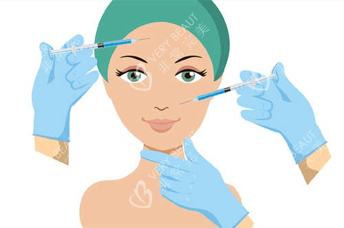 面部填充注射图