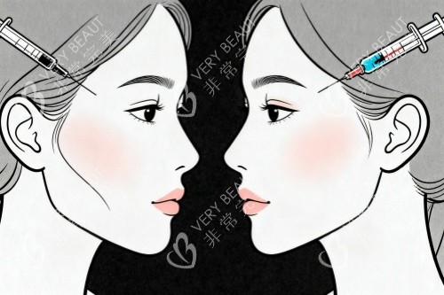 面部注射卡通图展示