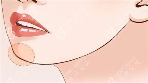 下巴填充对比 卡通 下巴填充对比 卡通