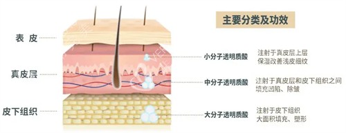 玻尿酸注射后皮肤变化 玻尿酸注射后皮肤变化