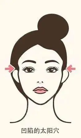 太阳穴凹陷整形手术