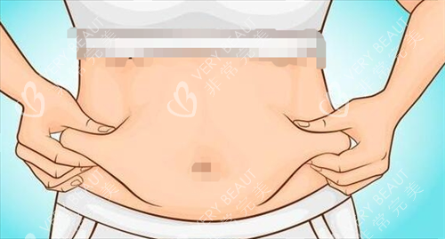 吸脂手术腹部脂肪堆积