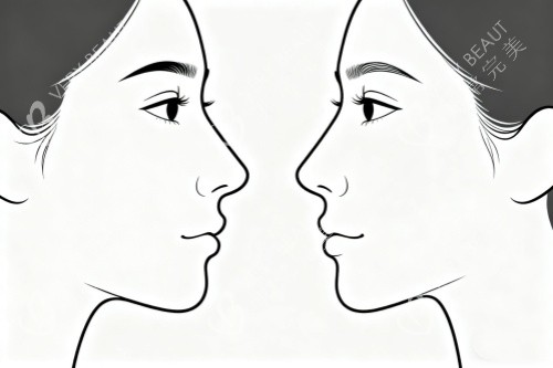 好看鼻型卡通展示图