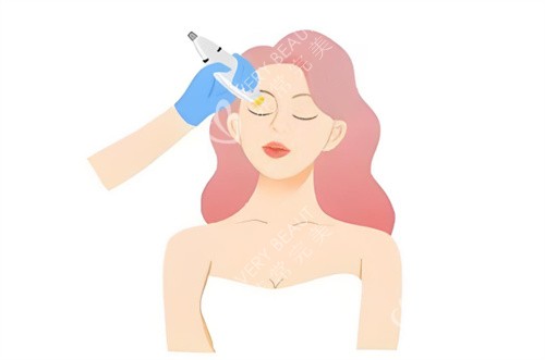 热玛吉操作图片