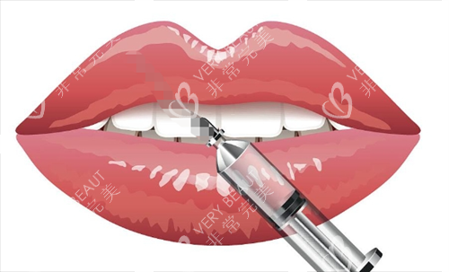 玻尿酸注射嘴巴动画展示