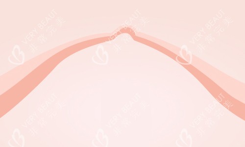 隆胸的意义 隆胸的意义