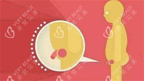 阴茎短小演示动画图