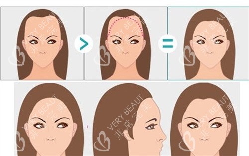 女性m型发际线卡通图