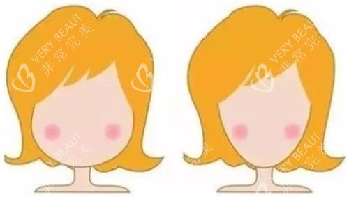 打针瘦脸明显对比图 打针瘦脸明显对比图