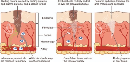 改善皮肤色素疤痕 改善皮肤色素疤痕