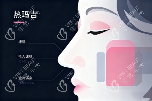 面部做热玛吉卡通图