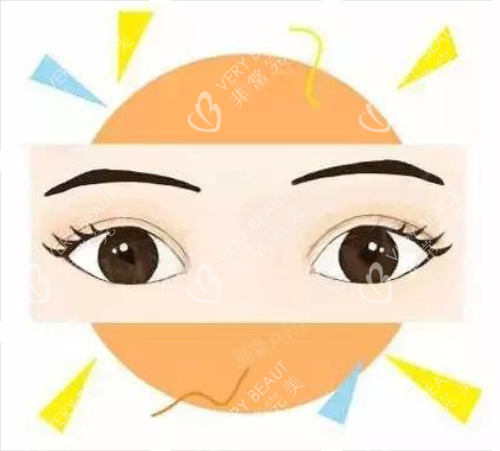 全切双眼皮***图