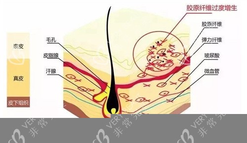 欧洲之星fotona4d各类模式照片