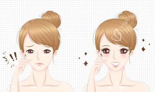 双眼皮术宣传图 双眼皮术宣传图