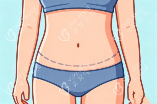 腹部吸脂卡通图一览