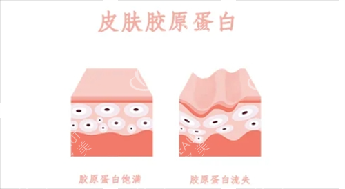 胶原蛋白在皮肤表面的动画示意图 胶原蛋白在皮肤表面的动画示意图