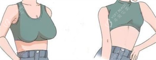 巨乳缩小