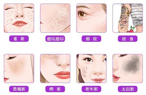 不同的皮肤斑点问题 不同的皮肤斑点问题