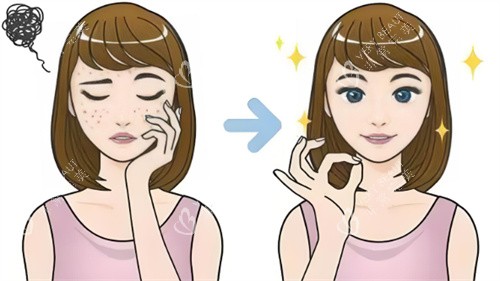 去痘印前后对比.jpg