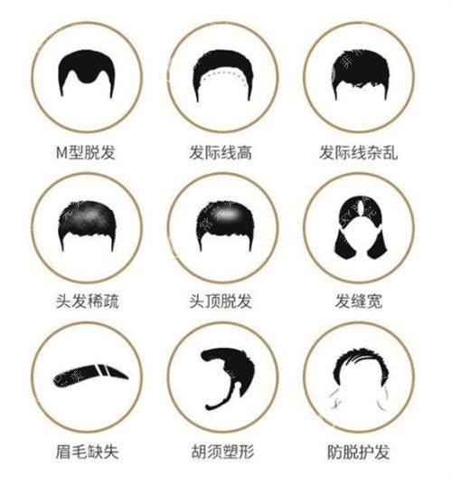各种需要植发的情况图.png