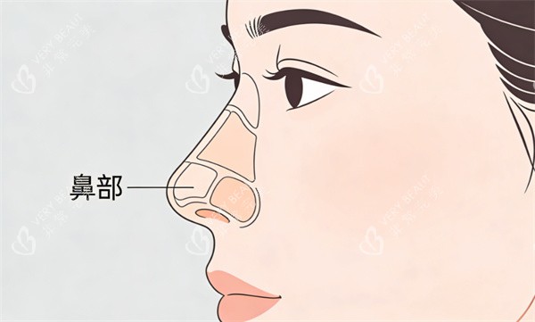 鼻部整形部位卡通图.jpg